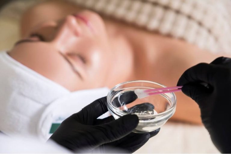 facial chemical peels procedure
