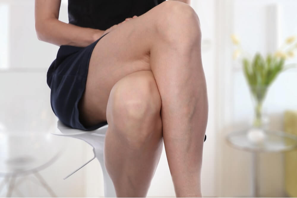 Sclerotherapy man's knee