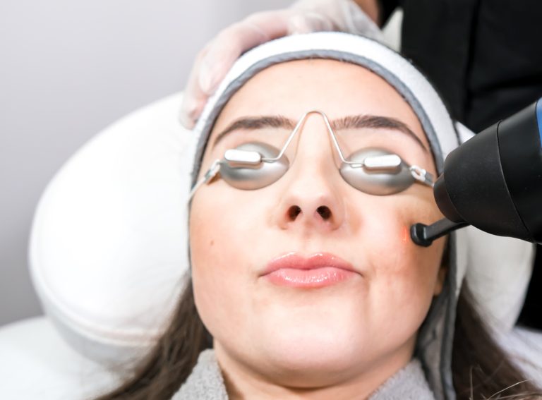 laser skin rejuvenating CO2