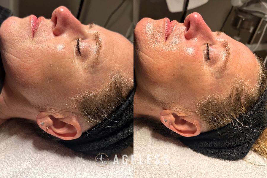 60 minute facial treatment