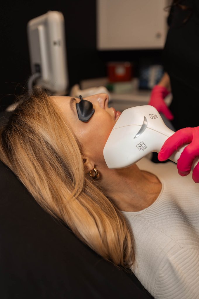 client receiving IPL Photofacial in Indianapolis, IN