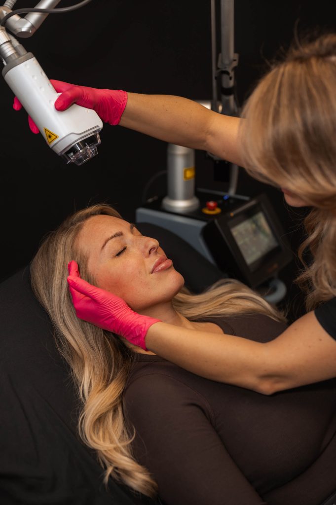 laser skin treatment Indianapolis