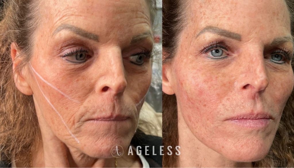 PDO Threads before and after