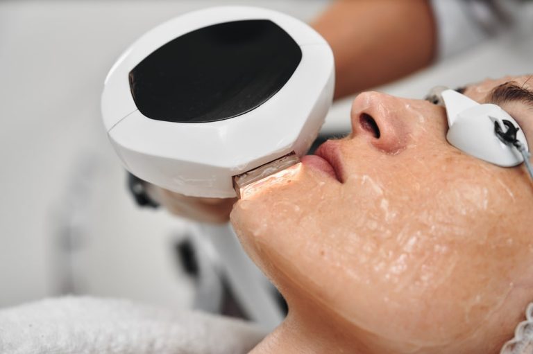 laser skin