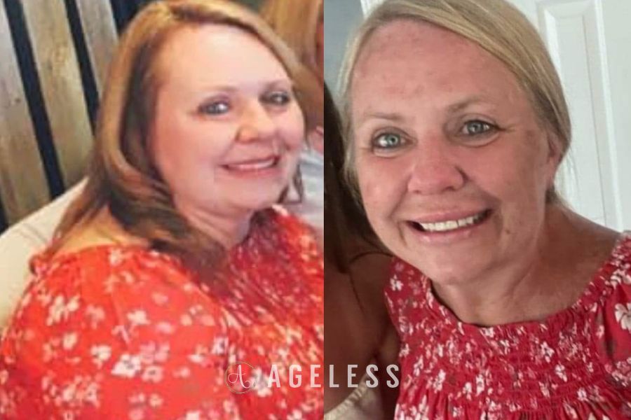 Medical weight loss before and after